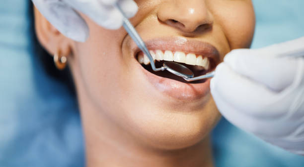 Best Emergency Dental Care for Broken or Chipped Teeth in Krum, TX