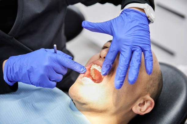Best Emergency Root Canal Treatment in Krum, TX